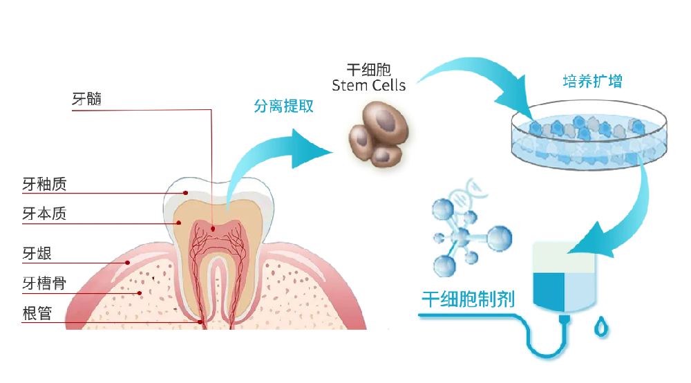 拔掉的牙齿可以用来储存牙髓干细胞吗？